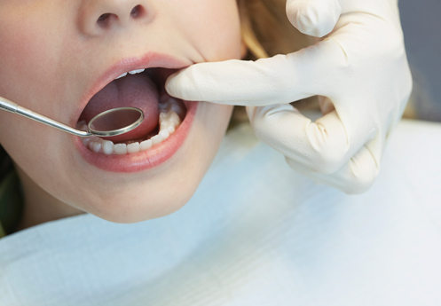 odontologia-infantil odontologia infantil
