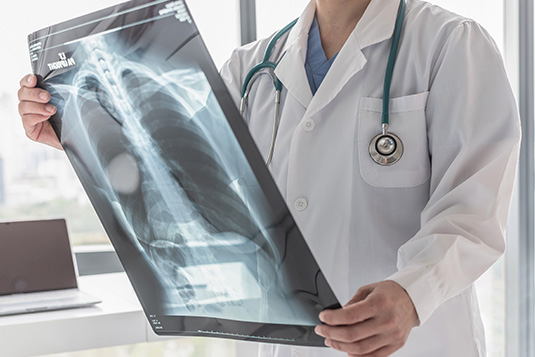 ¿Puede la hipertensión pulmonar causar voz ronca? ¿Puede la hipertensión pulmonar causar voz ronca?