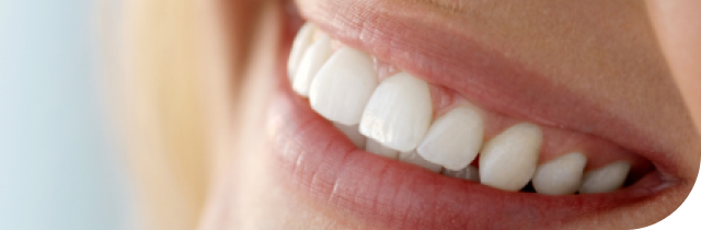 Paciente sonriendo con alineadores invisibles Invisalign en UC CHRISTUS