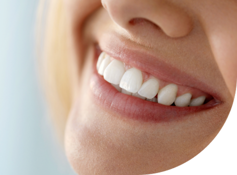 Paciente sonriendo con alineadores invisibles Invisalign en UC CHRISTUS