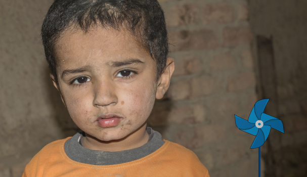 Infante con la cara manchada