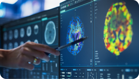 Médico revisando una resonancia con alteración estructural
